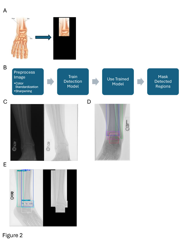 Ankle Replacement Figure 2